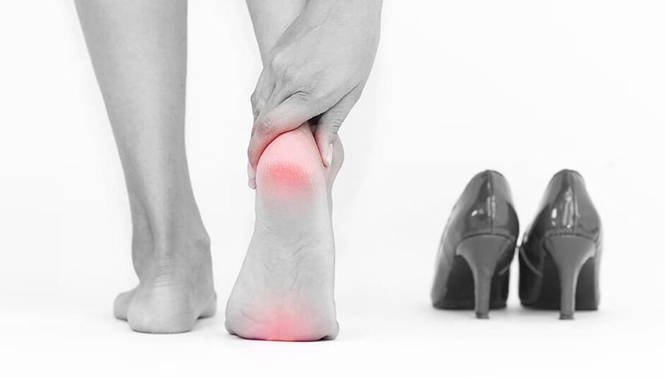 O uso de zapatos axustado é a causa da micose
