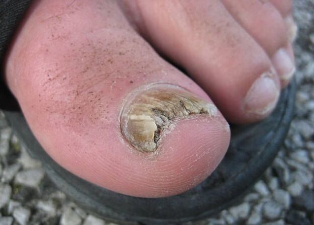 O resultado do descoido