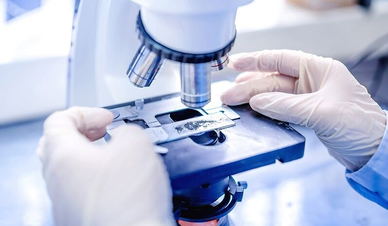 diagnóstico de laboratorio de fungos na unha do pé