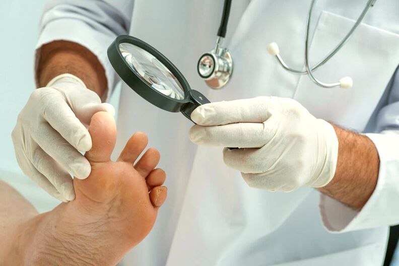 Dermatoloxía que examina as uñas dos pés