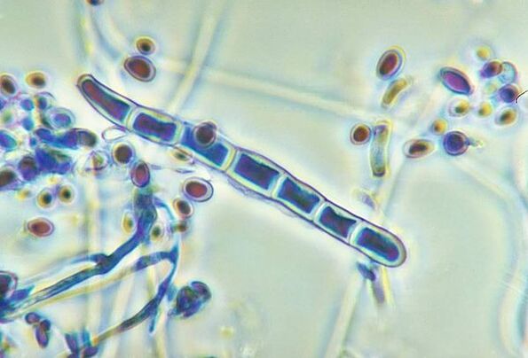 Fungo Trichophyton rubrum baixo o microscopio