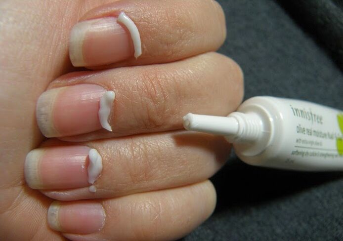 tratamento de fungos nas unhas con pomada