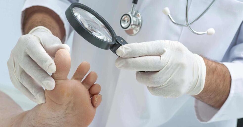 O médico examina os pés en busca de fungos